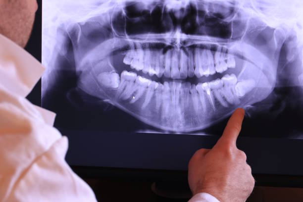 Best Emergency Dental Surgery in Georgiana, AL